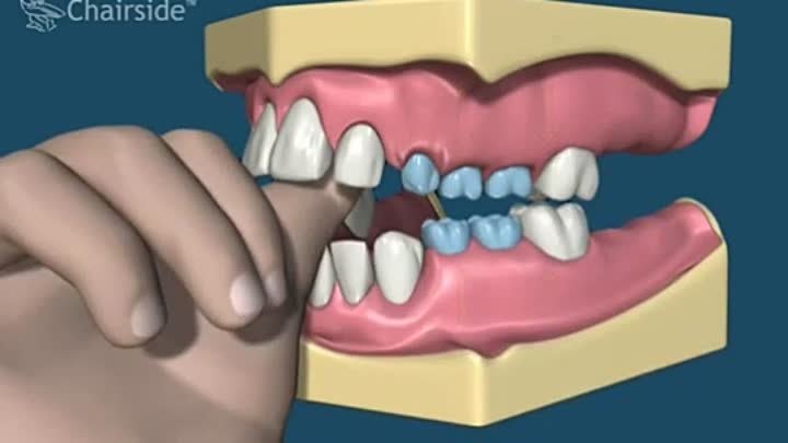 ПОЧЕМУ  зубы становятся кривыми, а прикус неправильным