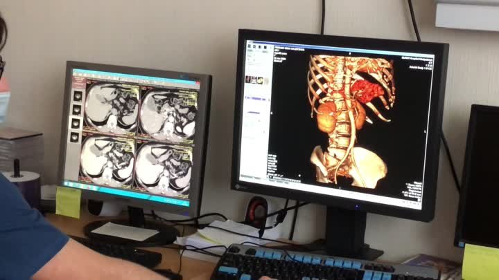 Компьютерная томография 