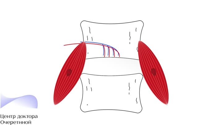 Что не так с межпозвонковым диском? - Центр доктора Очеретиной