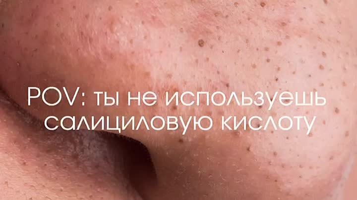 кислота