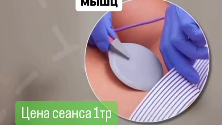 Видео