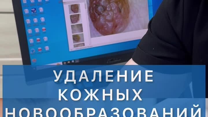 Удаление кожных новообразований в Клинике доктора Григоренко (Владив ...