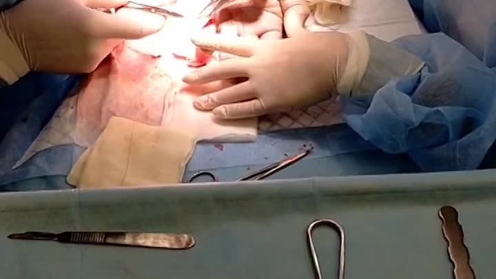 Хирургия кисти