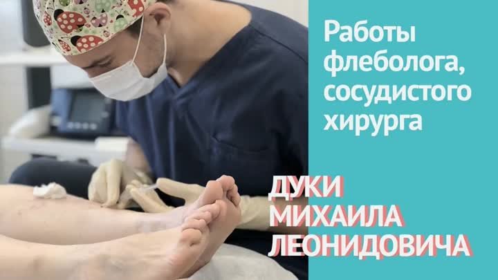 Лечение варикоза- радиочастотная абляция вен. Работы флеболога Дуки М.Л.