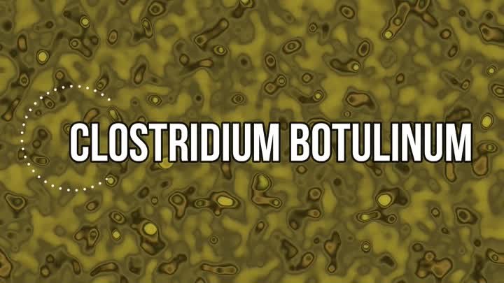 Usmle Videos - (dratef.net) Botulism And Botox ( Clostridium Botulinum) ( medical.shoppingdealer.com )