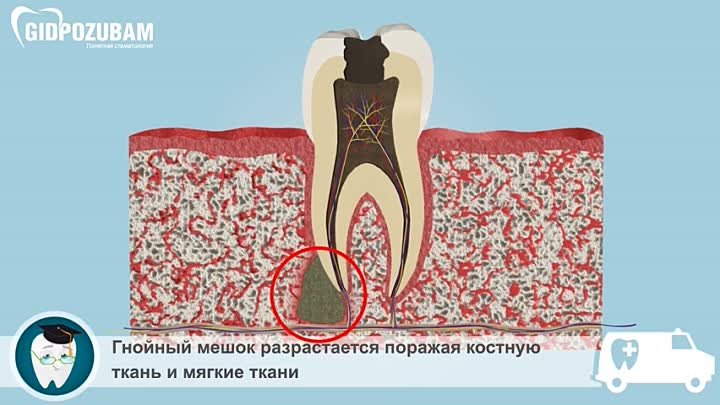 Виды заболеваний зубов