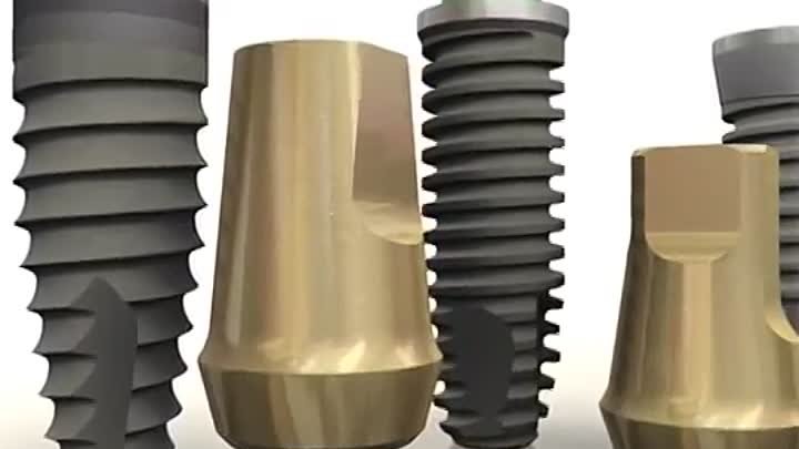 Dental Implants video