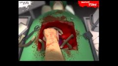 Обзор игры:Surgeon Simulator 2013™