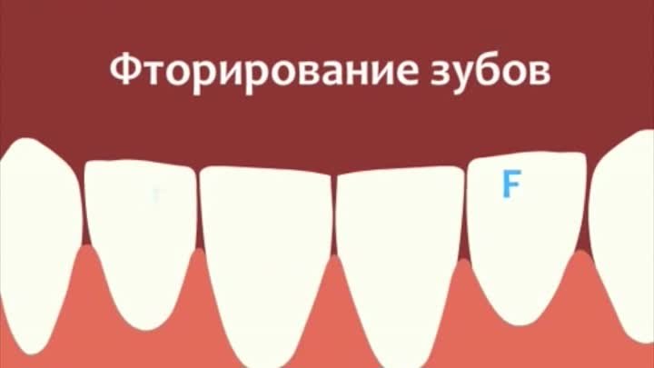 Что представляет собой процедура глубокого фторирования зубов?