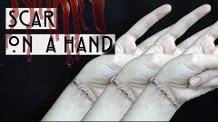 Шрам на руке|Scar on a hand