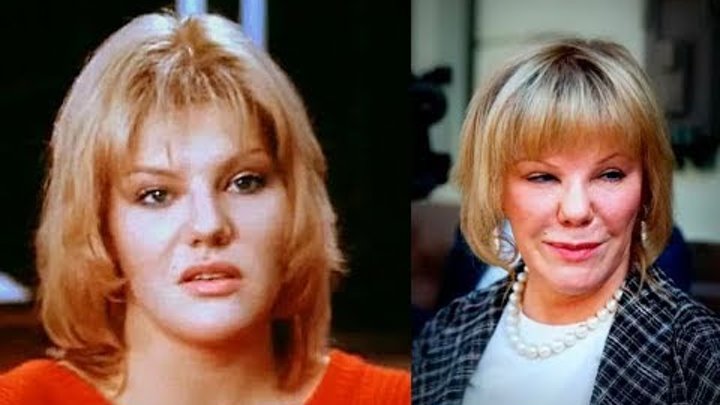 Александра захарова пластика фото Александра захарова пластика фото