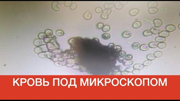 Как посмотреть кровь под микроскопом Как посмотреть кровь под микроскопом