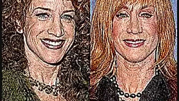 Кузьмин после пластики фото Кузьмин после пластики фото