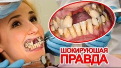 5 ЖУТКИХ ФАКТОВ О ЖВАЧКЕ. Слабонервным не смотреть!!!