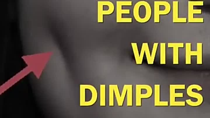 Dimples