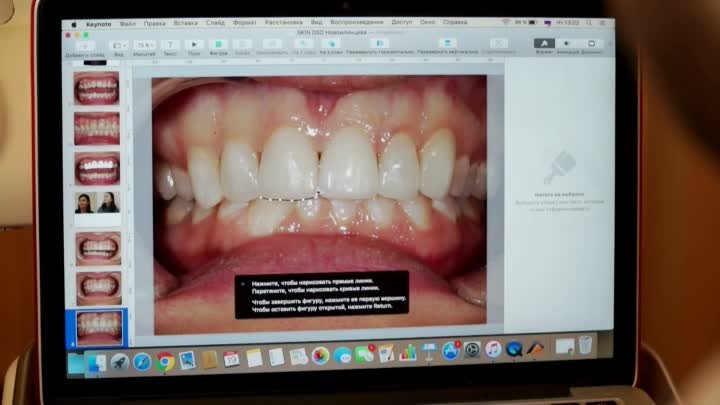 Skin концепция - новый взгляд на ортопедическую стоматологию.