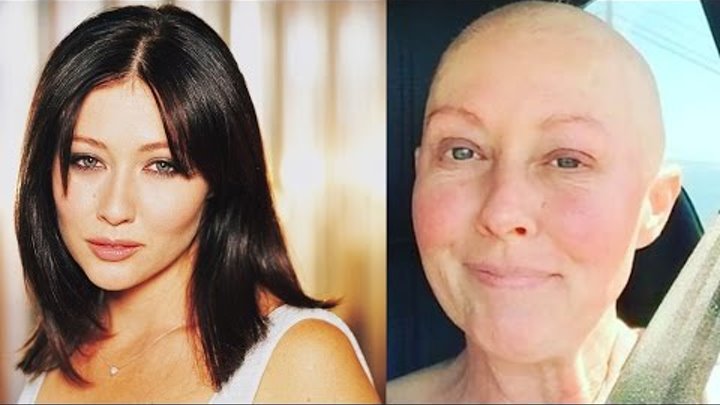 До и после рака фото До и после рака фото