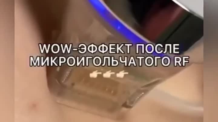 Видео