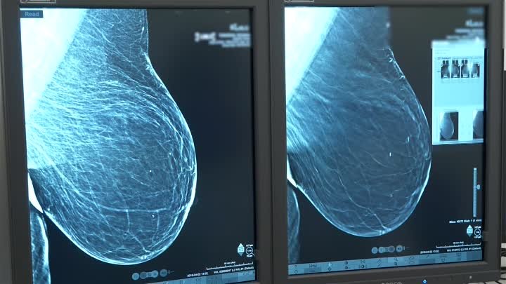 Комбинированная диагностика рака груди