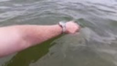 Как выглядит укус медузы Как выглядит укус медузы