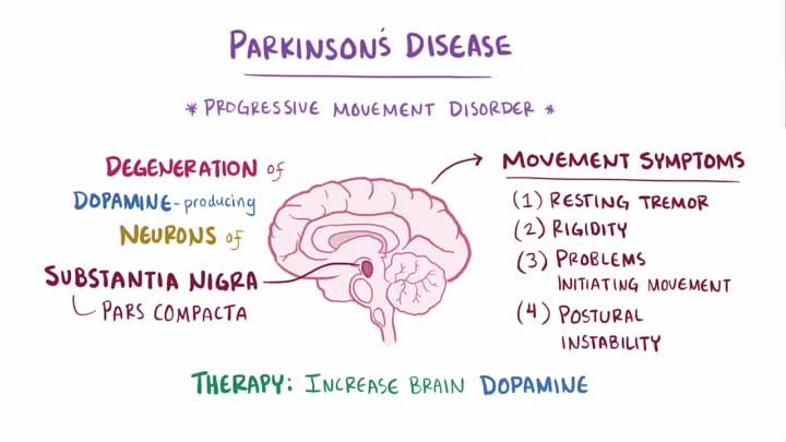 Parkinson's disease - causes, symptoms, diagnosis, treatment &am ...