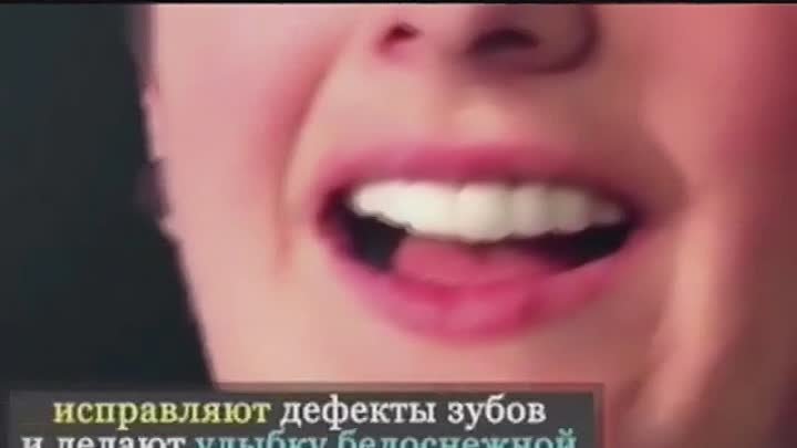 Snap-on-smile 2в1 - элайнеры + виниры! ️