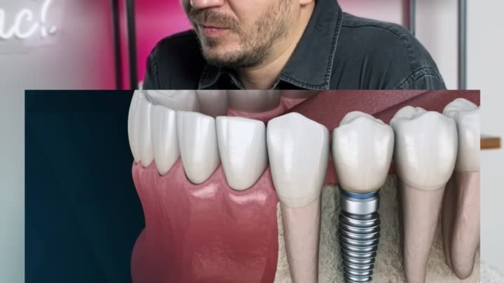 Бороться за зуб или удалить и поставить имплантат 🦷