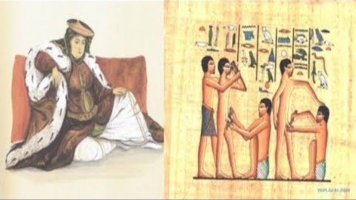 Как выглядит евнух после операции Как выглядит евнух после операции