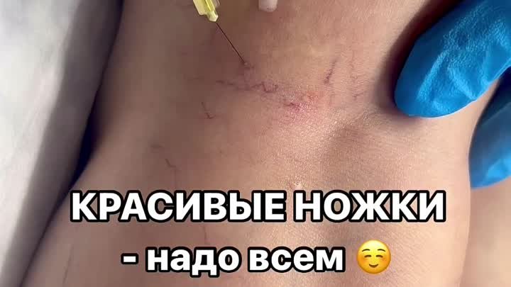 Видео