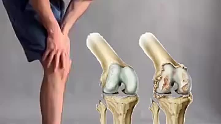 Комплекс упражнений для профилактики боли в коленях 🤞