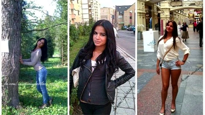 Анастасия до и после пластики Анастасия до и после пластики