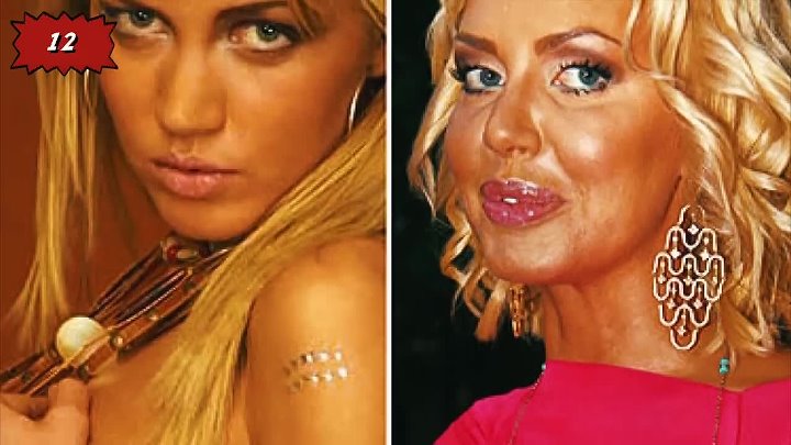 Пластика изуродовала фото Пластика изуродовала фото