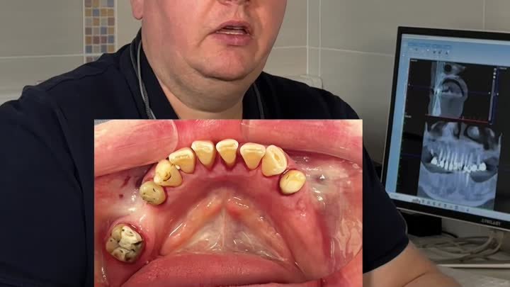 Полное преображение зубов за 4 месяца 🌟 Не волшебство. Результат ко ...