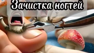 Мои любимые вкусняшки!!!
👣Зачистка ногтей, как это проходит?