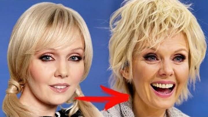 Валерия фото до и после Валерия фото до и после