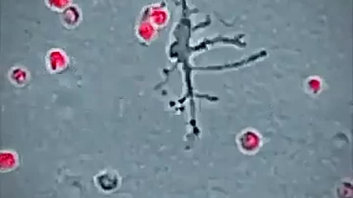 Лейкоциты уничтожают патогенные микроорганизмы