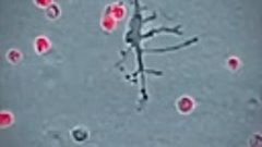 Лейкоциты уничтожают патогенные микроорганизмы