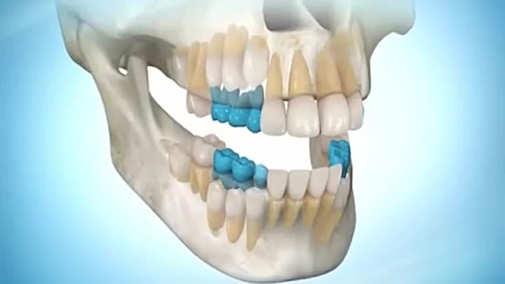 смена забов, 3D