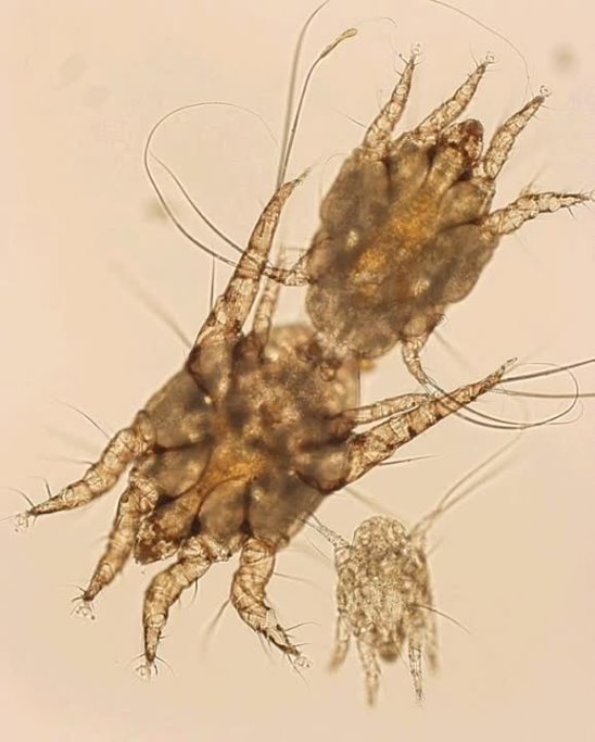 Как выглядит ушной клещ у человека Как выглядит ушной клещ у человека