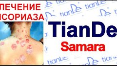 Псориаз, лечение - TianDe Samara