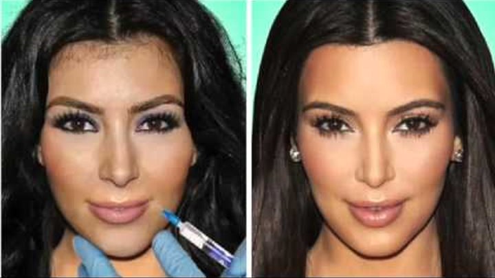 Ким кардашян до и после пластики Ким кардашян до и после пластики