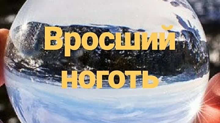 Добрый всем🙌🏻

Вросший ноготь - онихокриптоз 🦶🏻

Результат быстр ...