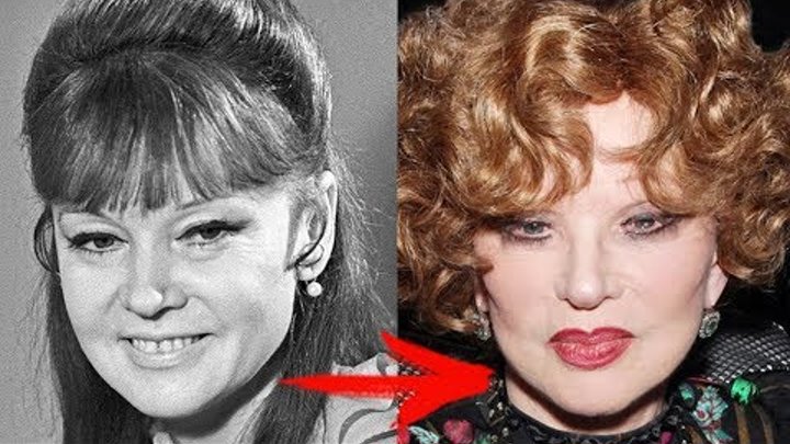 Гурченко людмила после пластики фото Гурченко людмила после пластики фото